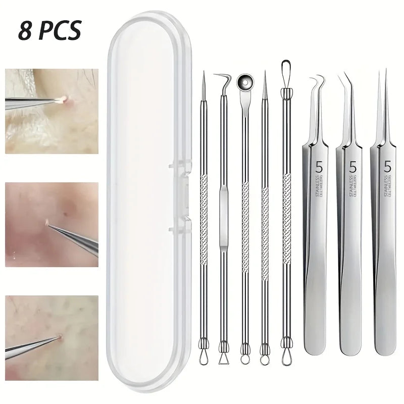 8-Piece Stainless Steel Blackhead Remover